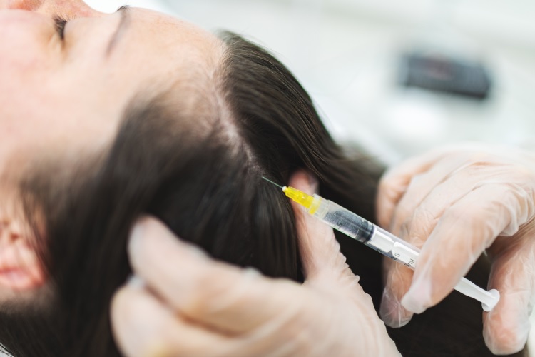 Exosomes for hair loss