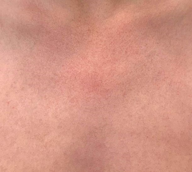 2 Sessions of Moxi