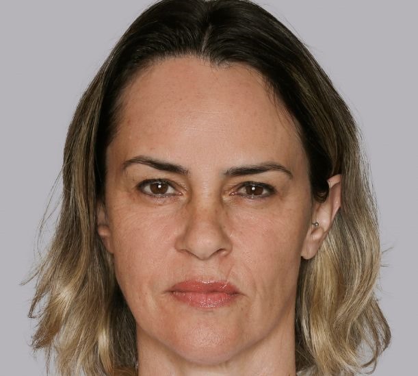 6 months after treatment
