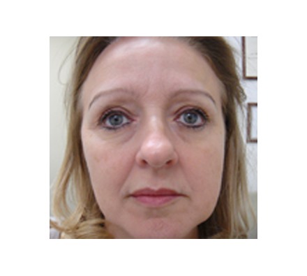 Full face