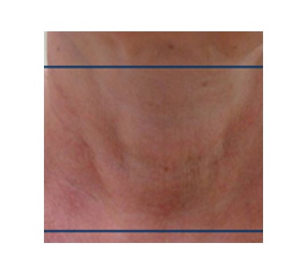 Neck