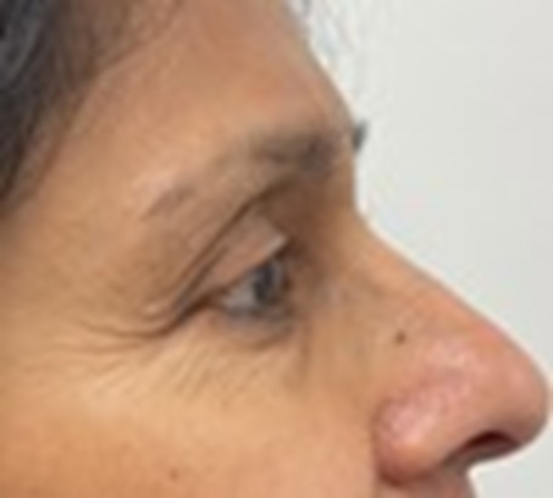 Polynucleotide crows feet before and after