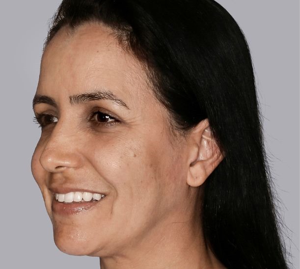 6 months after treatment