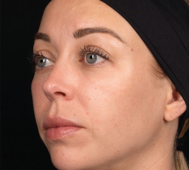 4 days after treatment