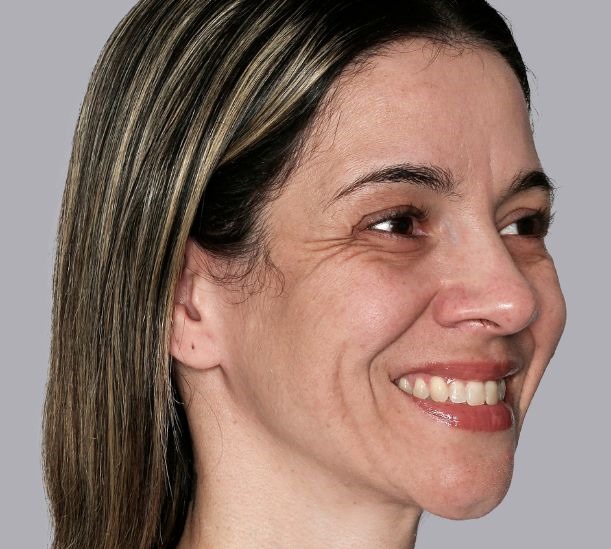 6 months after treatment