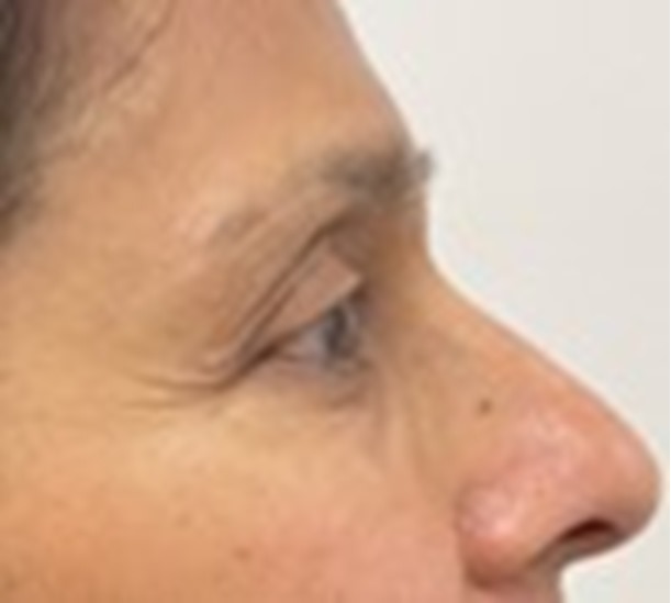 Polynucleotide crows feet before and after