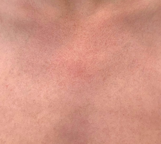 2 Sessions of Moxi