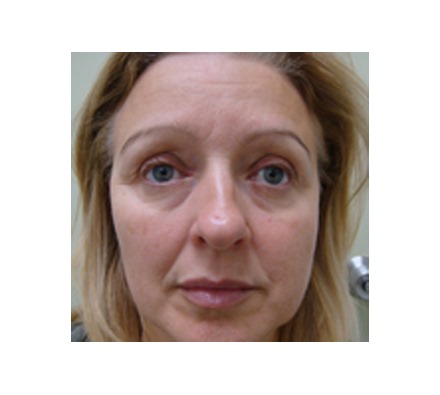 Full face