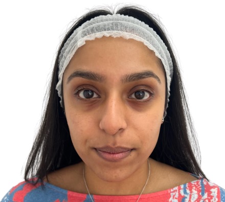 Polynucleotide Under-eye Treatment