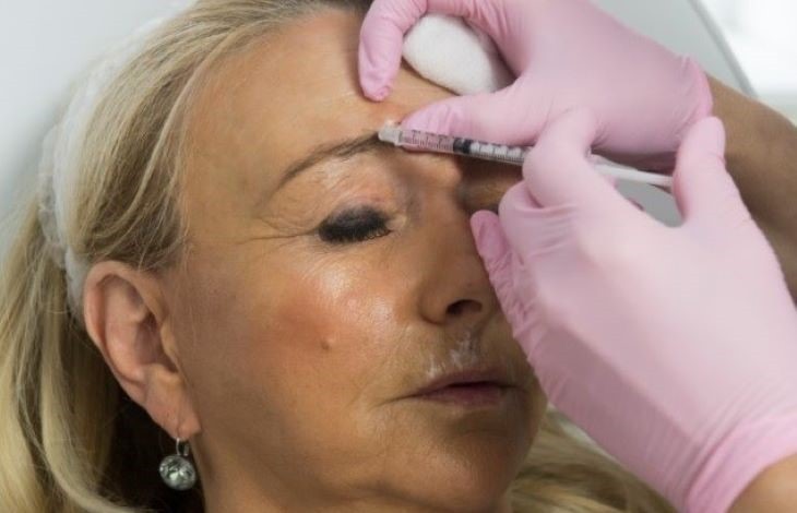 anti wrinkle injections