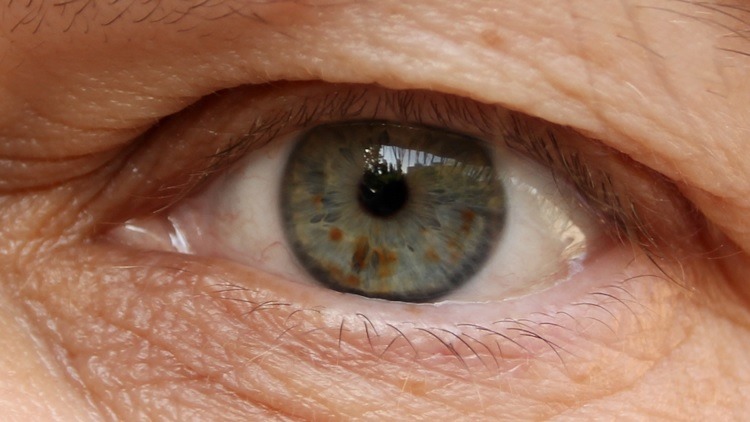 Hooded Eye
