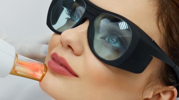 Redness reduction laser treatment