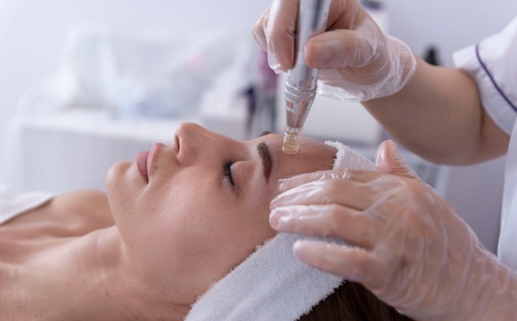 What is Imedpen microneedling?
