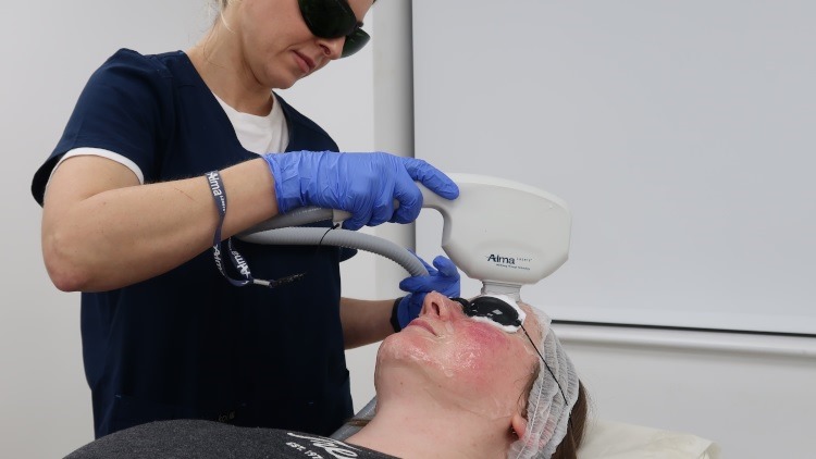 Pigmentation laser