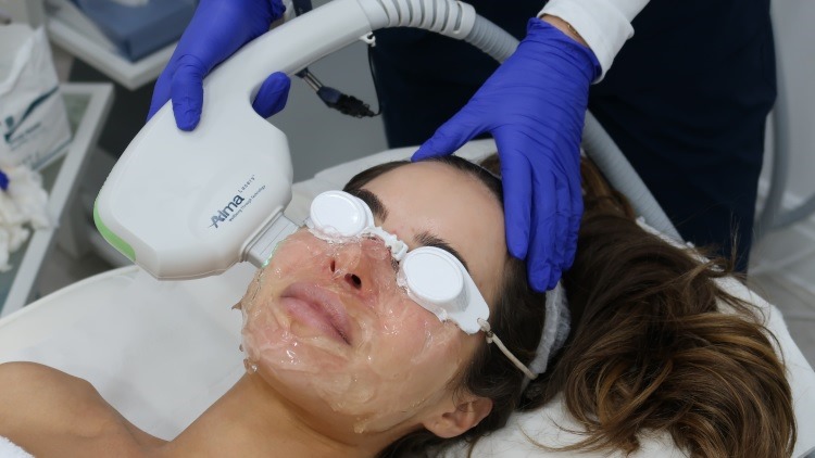 Clearlift laser treatment