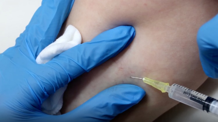 Dr Leah Clinics leg vein removal London