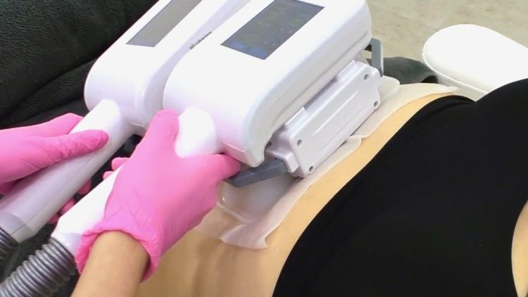 Cryolipolysis (Fat Freezing)