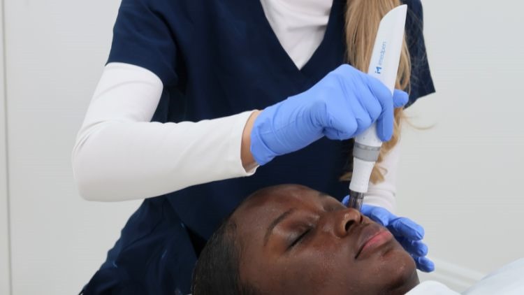 Mandelic acid peel with microneedling dr leah clinics london