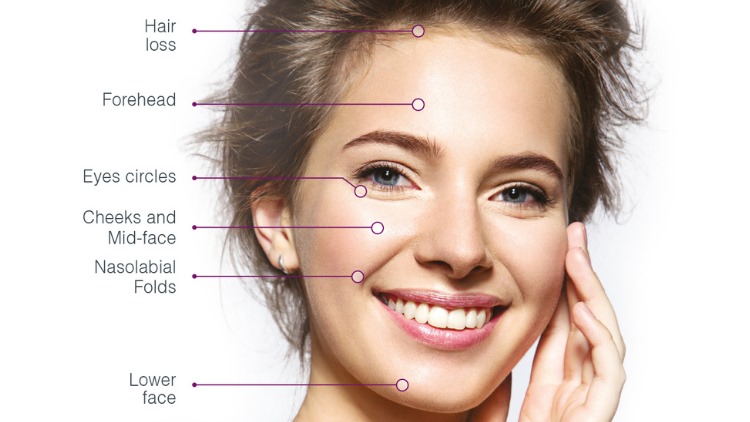 What is PRP? 
