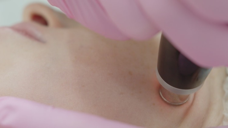 What does the anti-acne, deep exfoliation, blackhead extraction facial involve?