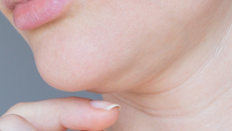 Aqualyx® fat dissolving injections in London and Essex