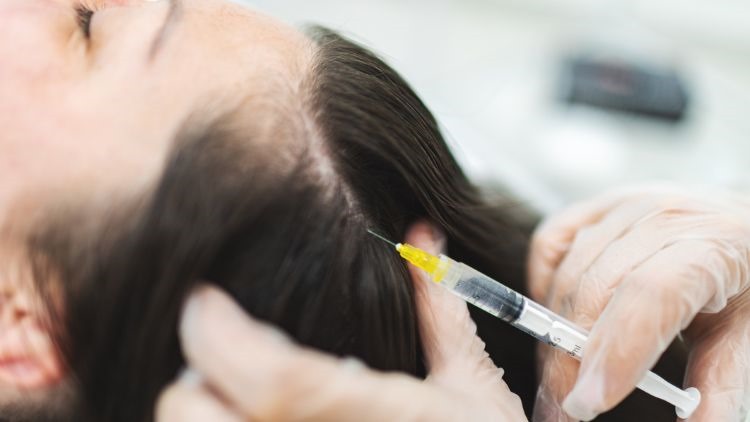 What is PRP treatment for hair?