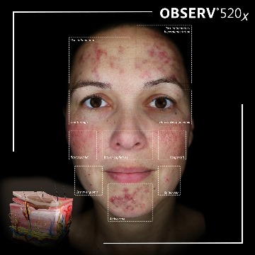 Skin consultations in London and Essex