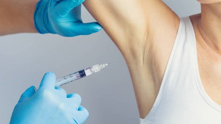 hyperhidrosis treatment