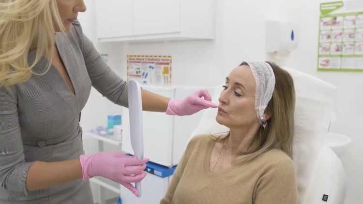 Lip filler